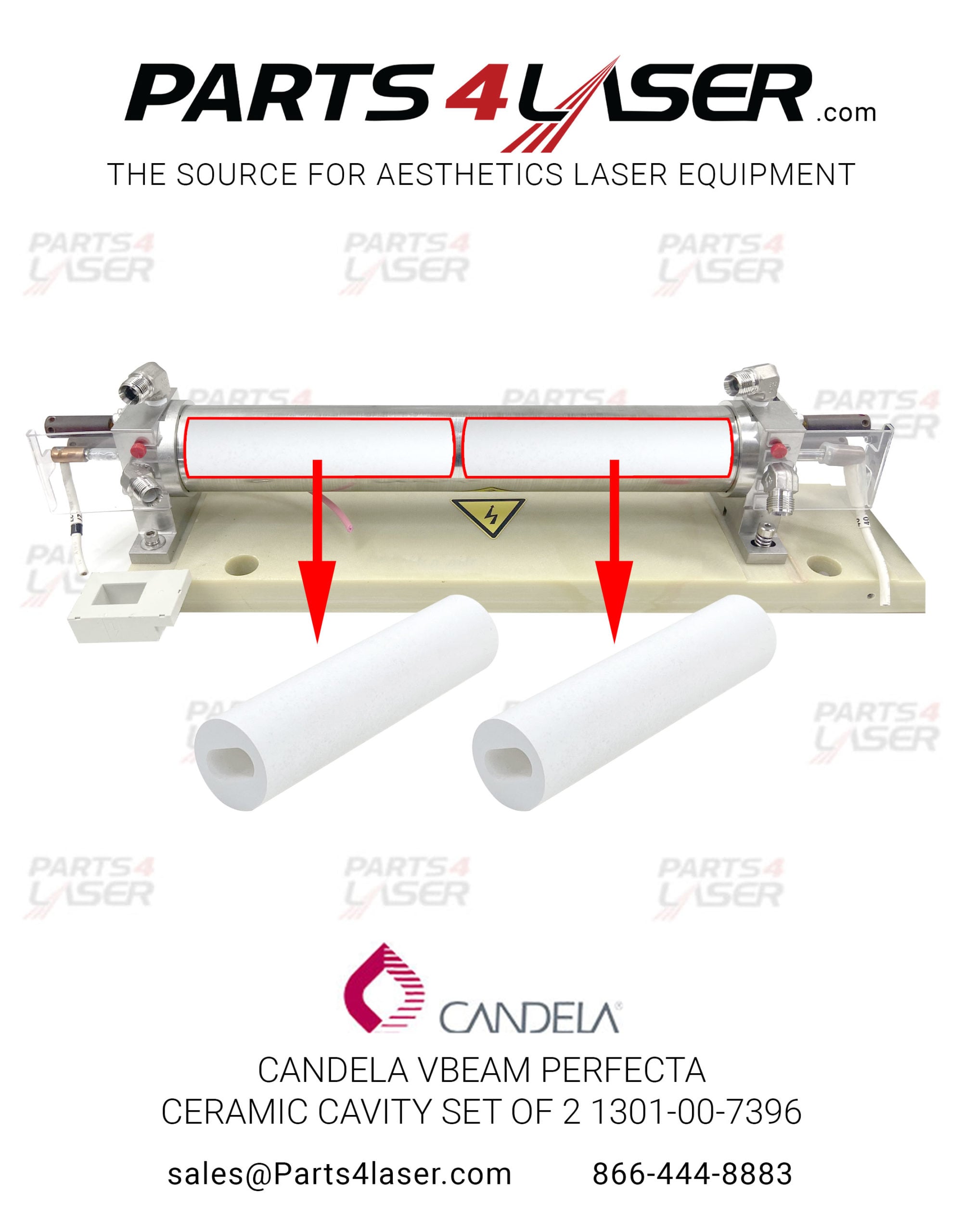 CANDELA VBEAM PERFECTA , VBEAM 1 CERAMIC CAVITY SET OF 2 1301-00-7396 , CACN1490 D16