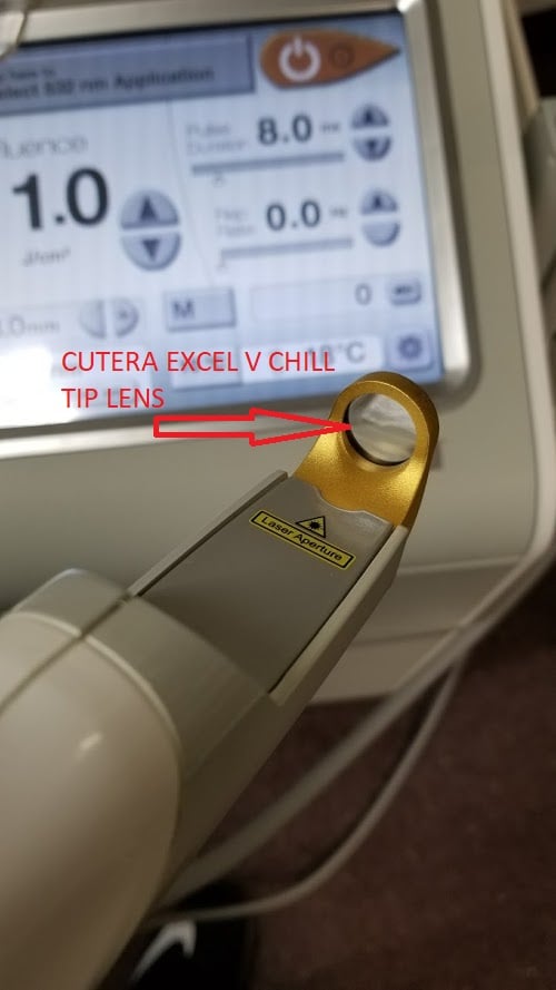 CUTERA EXCEL V VASCULAR COOLVIEW HAND PIECE LENS , CUTERA EXCELV CHILL TIP OPTIC LENS CUOP1541 -- B32