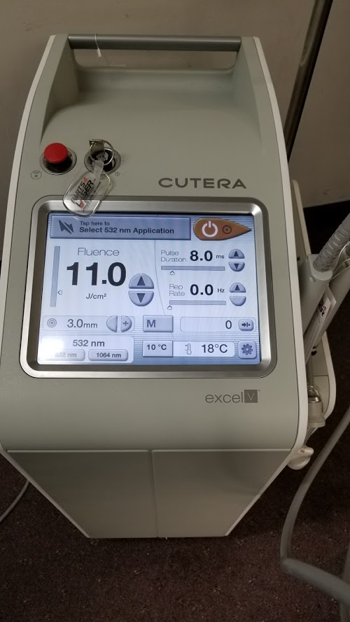 CUTERA EXCEL V VASCULAR COOLVIEW HAND PIECE LENS , CUTERA EXCELV CHILL TIP OPTIC LENS CUOP1541 -- B32 - Image 3