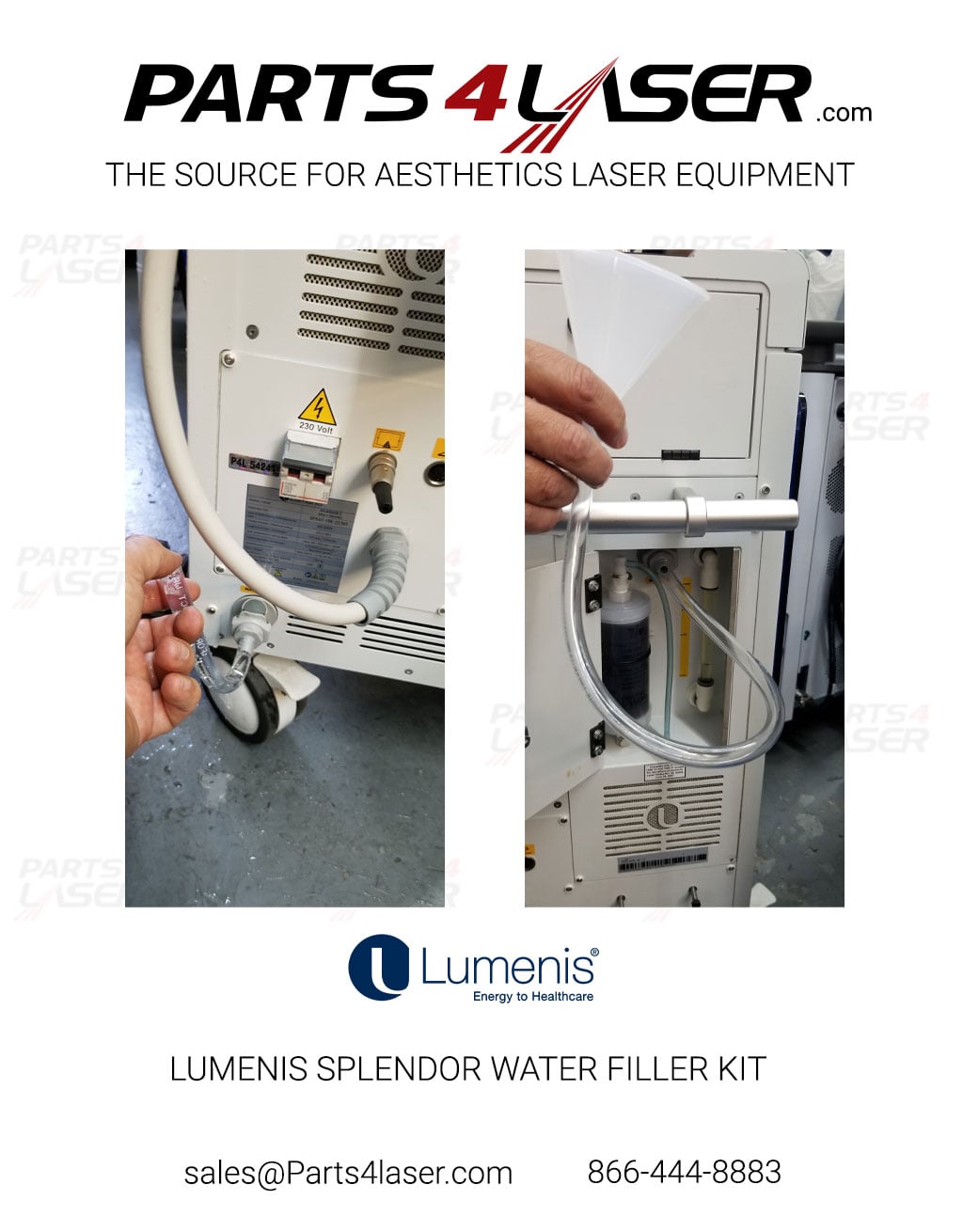 LUMENIS SPLENDOR WATER FILLER KIT Load/Unload Water Kit SPNB151130 AV0254 LUCN3279 - Image 2