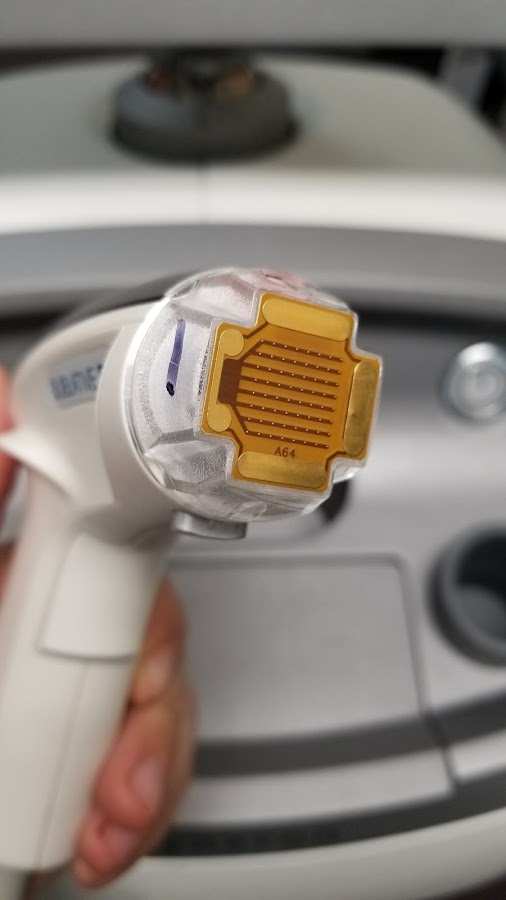 SYNERON ETWO STANDARD 64 200 PULSE KT72931 KT 72931 - Image 4