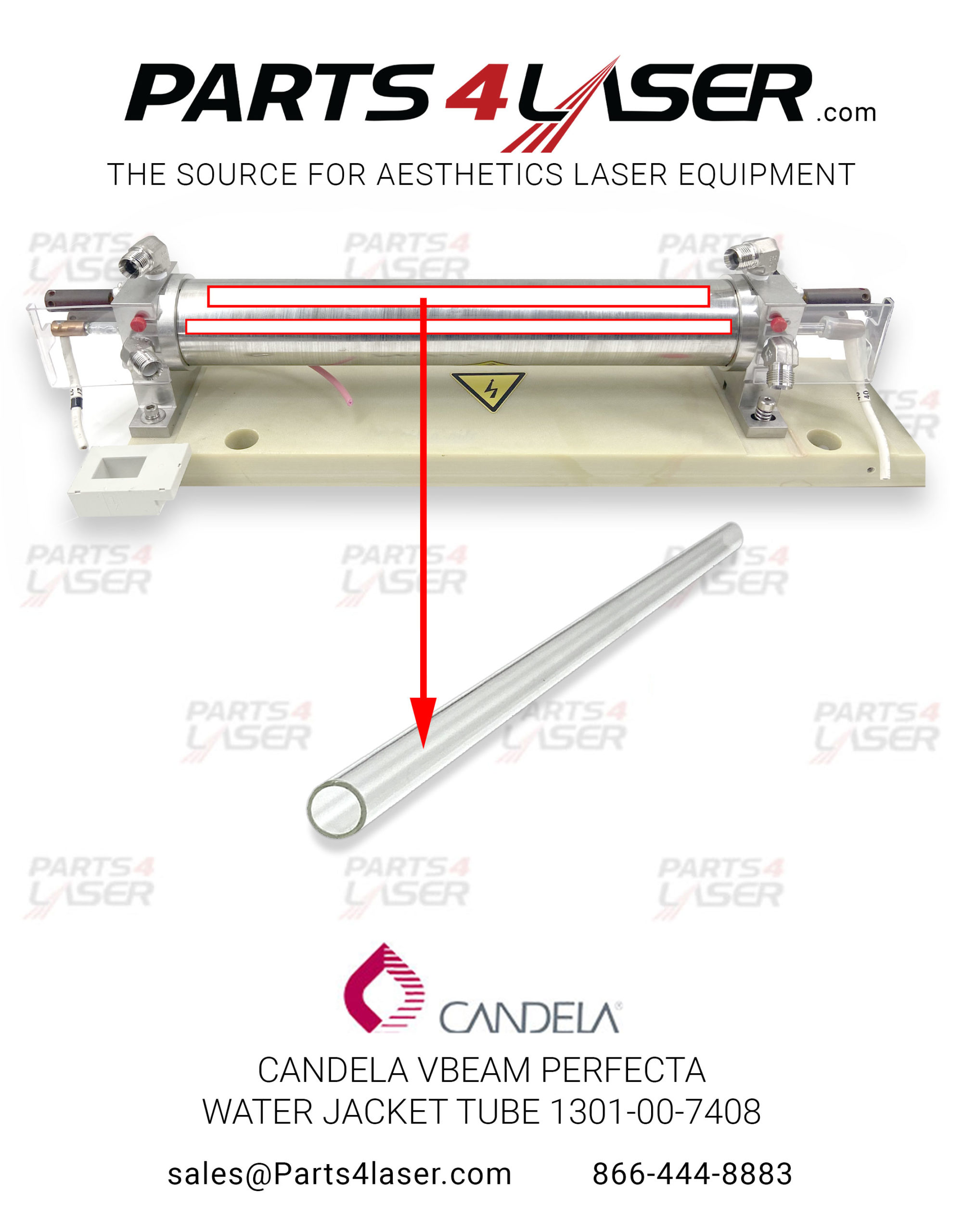 CANDELA VBEAM PERFECTA WATER JACKET TUBE 1301-00-7408 CACN1500